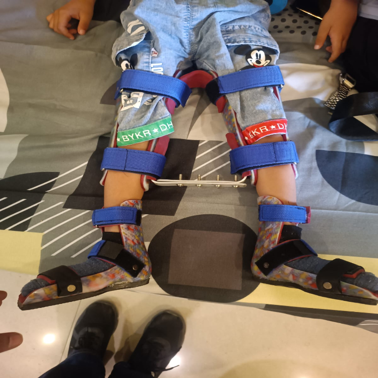 Hip Extension Abduction Brace