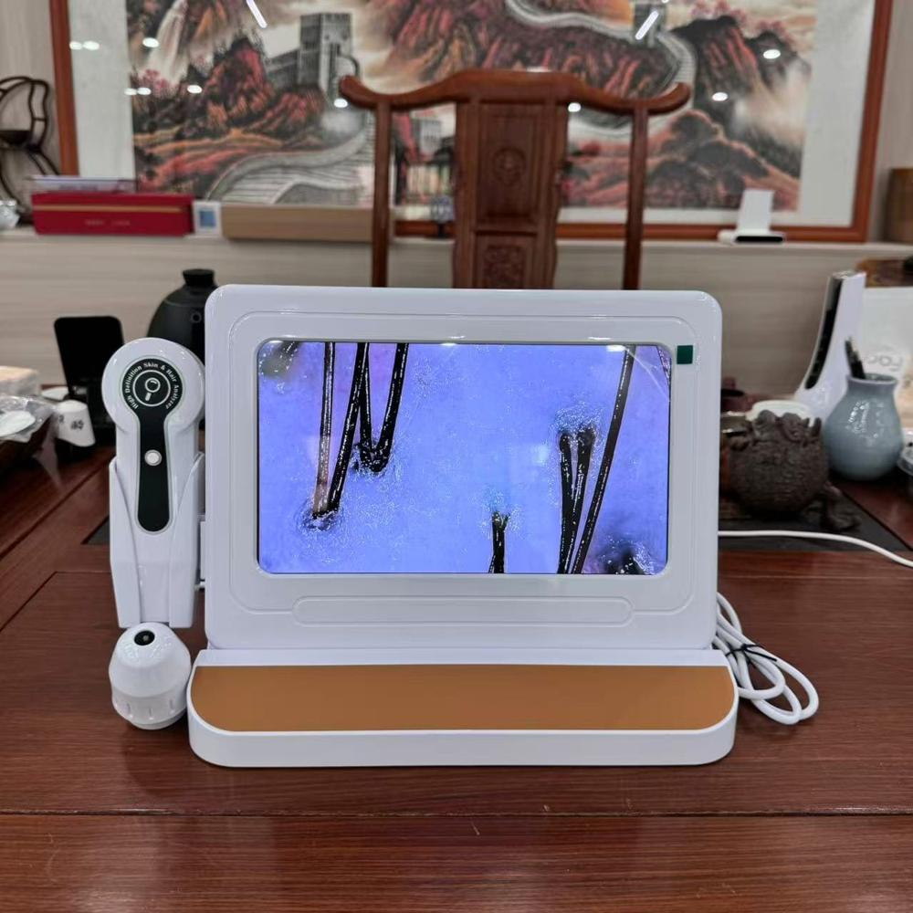 Skin Scalp Analyser