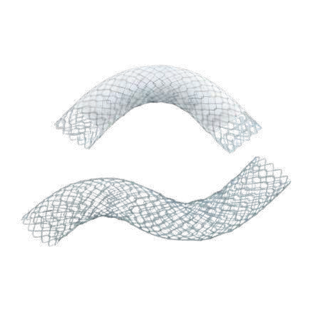 Colonic Stent