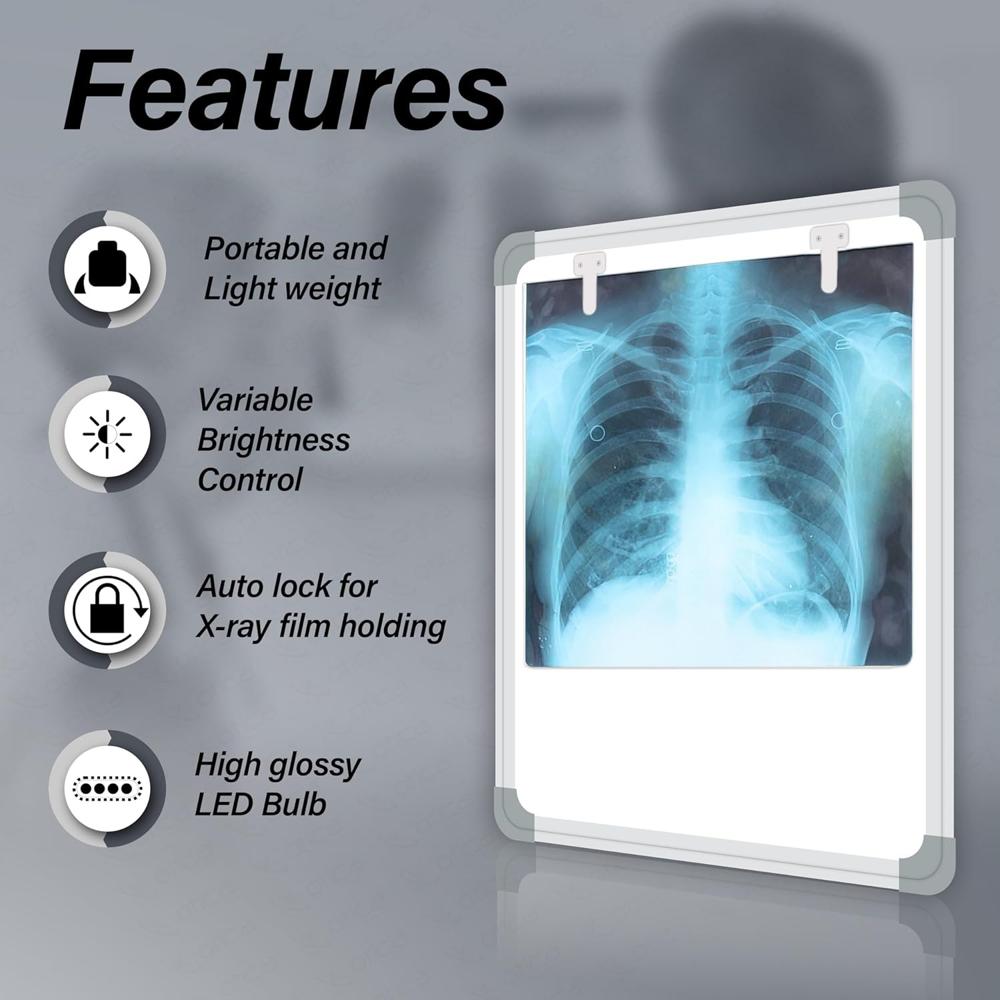Otica Fully Automatic X-ray View Box - Attributes: Auto Sensor On/off
