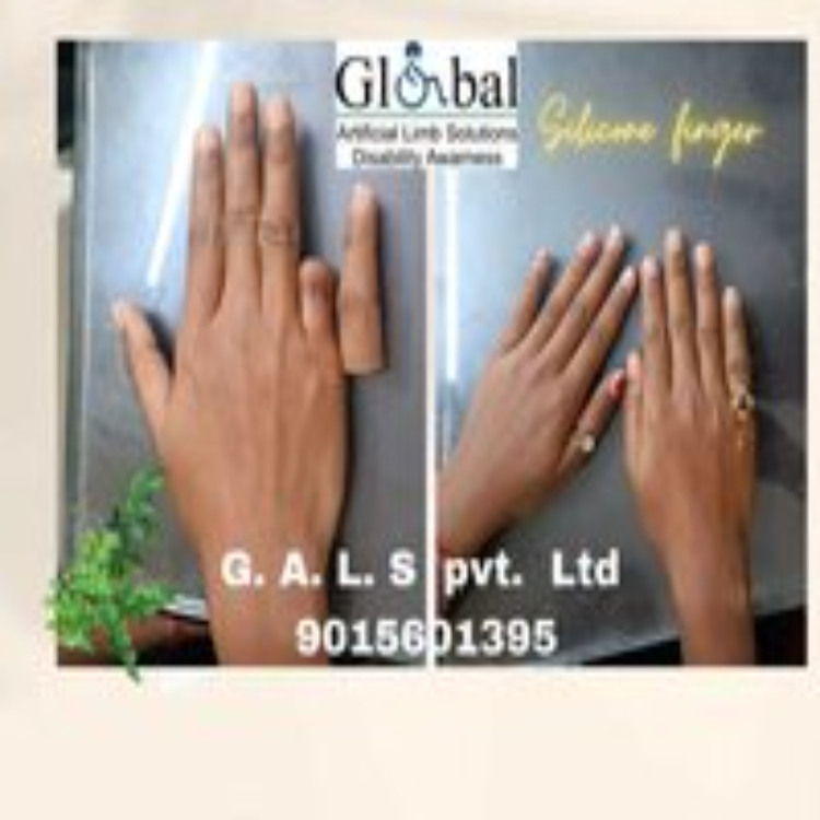 Artificial Silicone Finger - Durable High-quality Silicone Material, Customizable Skin-colored Design For Enhanced Surgical Precision