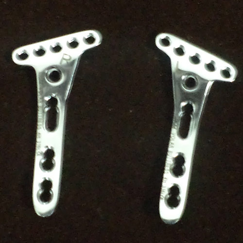 Volar Buttress Radius Locking Plates