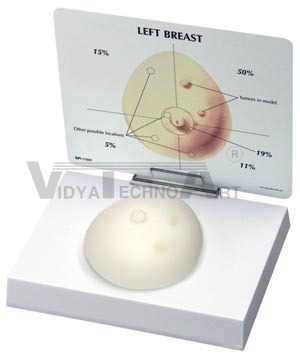 ब्रेस्ट कैंसर मॉडल