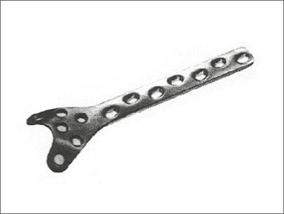 Condylar Buttress Plate - Metal, 4.5mm/4.8mm, 6-16 Hole Sizes | High Material Strength, Accurate Dimensions, Long Lasting Quality
