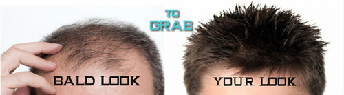 हेयर पैच