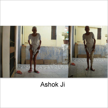 घुटने का ब्रेस