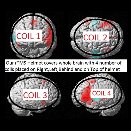 हमारे RTMS हेलमेट कॉइल्स