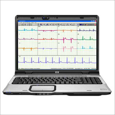 स्पष्टता ECG
