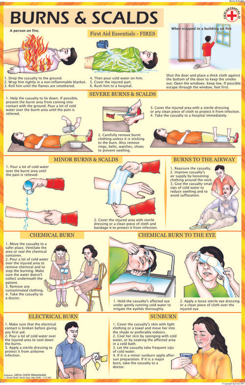 बर्न्स एंड स्कैल्ड्स चार्ट आयाम: 70 X 100 सेंटीमीटर (Cm)