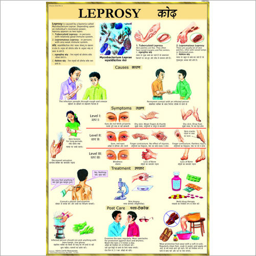 कुष्ठ रोग उपचार चार्ट आयाम: 70 X 100 सेंटीमीटर (Cm)