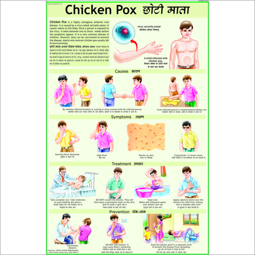 चिकन पॉक्स चार्ट आयाम: 70 X 100 सेंटीमीटर (Cm)