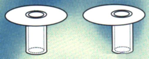 Partial Ossicular Repalcement Prosthesis: (PORP)