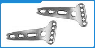 बट्रेस लॉकिंग प्लेट