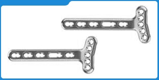 डिस्टल रेडियस लॉकिंग प्लेट