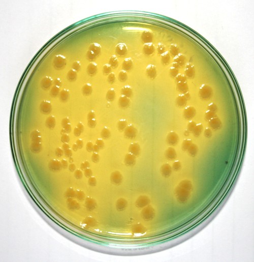Bromo Thymol Blue
