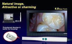 कैमरा डेंटल