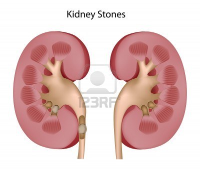 Nepron Plus For Kidney Care