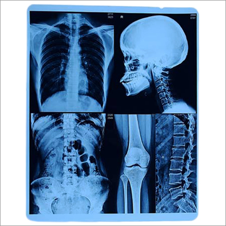 X-Ray Printing Film