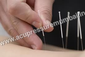 ACUPUNCTURE NEEDLE WITH TUBE SIZE 0.5" ( 0.25X0.13)