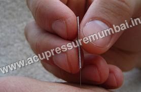 ACUPUNCTURE NEEDLE WITH TUBE SIZE 2" ( 0.25X0.60)