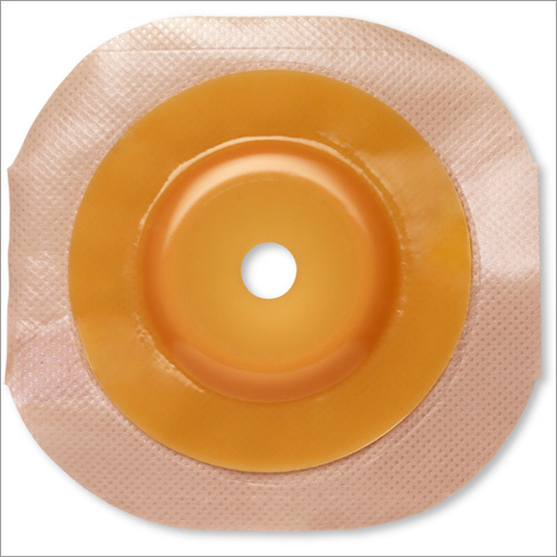 कोलोस्टीमी कॉन्वेक्स फ्लेंज