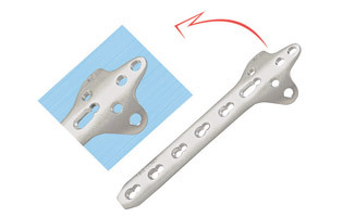 लॉकिंग क्लोवरलीफ प्लेट