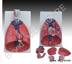 Larynx Heart And Lung Model at Best Price in New Delhi | Multicare ...