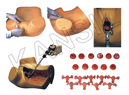 स्त्री रोग संबंधी परीक्षा मॉडल