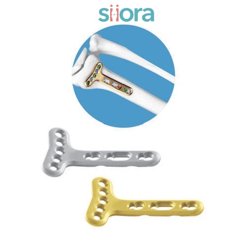 लॉकिंग एक्स्ट्रा आर्टिकुलर स्मॉल टी प्लेट