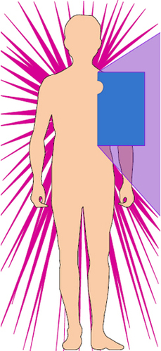 EP बाएँ सबक्लावियन शील्ड