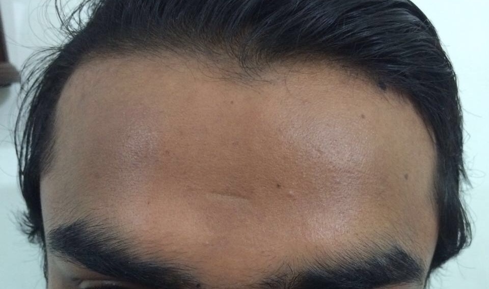 Skin Rejuvenation Services - Advanced Anti-aging Solutions For Lasting Youthful Glow | Resurfacing, Fillers, Laser Treatments, Preventive Care, Non-invasive Techniques