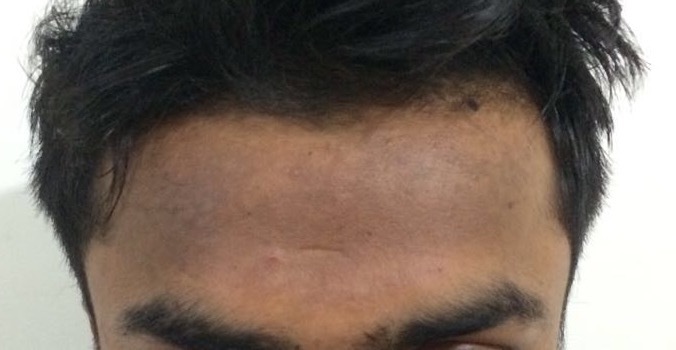 Skin Rejuvenation Services - Advanced Anti-aging Solutions For Lasting Youthful Glow | Resurfacing, Fillers, Laser Treatments, Preventive Care, Non-invasive Techniques