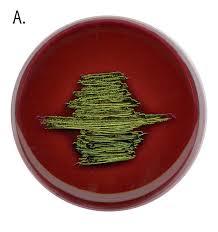 ईओसिन ब्लू