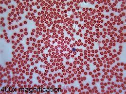 Wrighta  s Stain