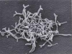 Bifidobacterium Longum - Additives: Food