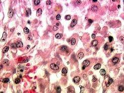 रोडोकोकस