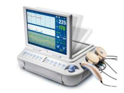 Fetal Monitor