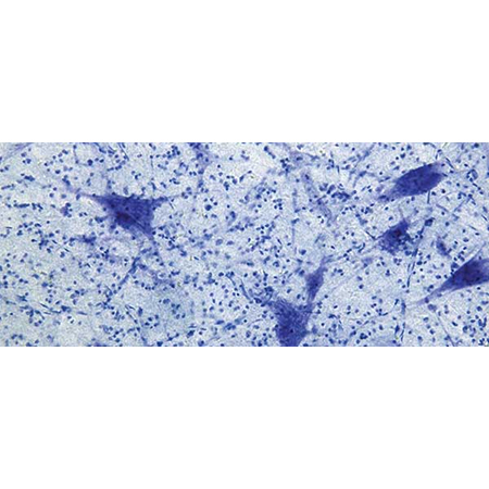 हिस्टोलॉजी रेजेंट्स