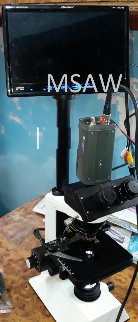Binocular Microscope With Led Screen