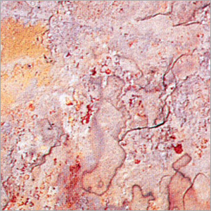 भारतीय शरद पत्थर