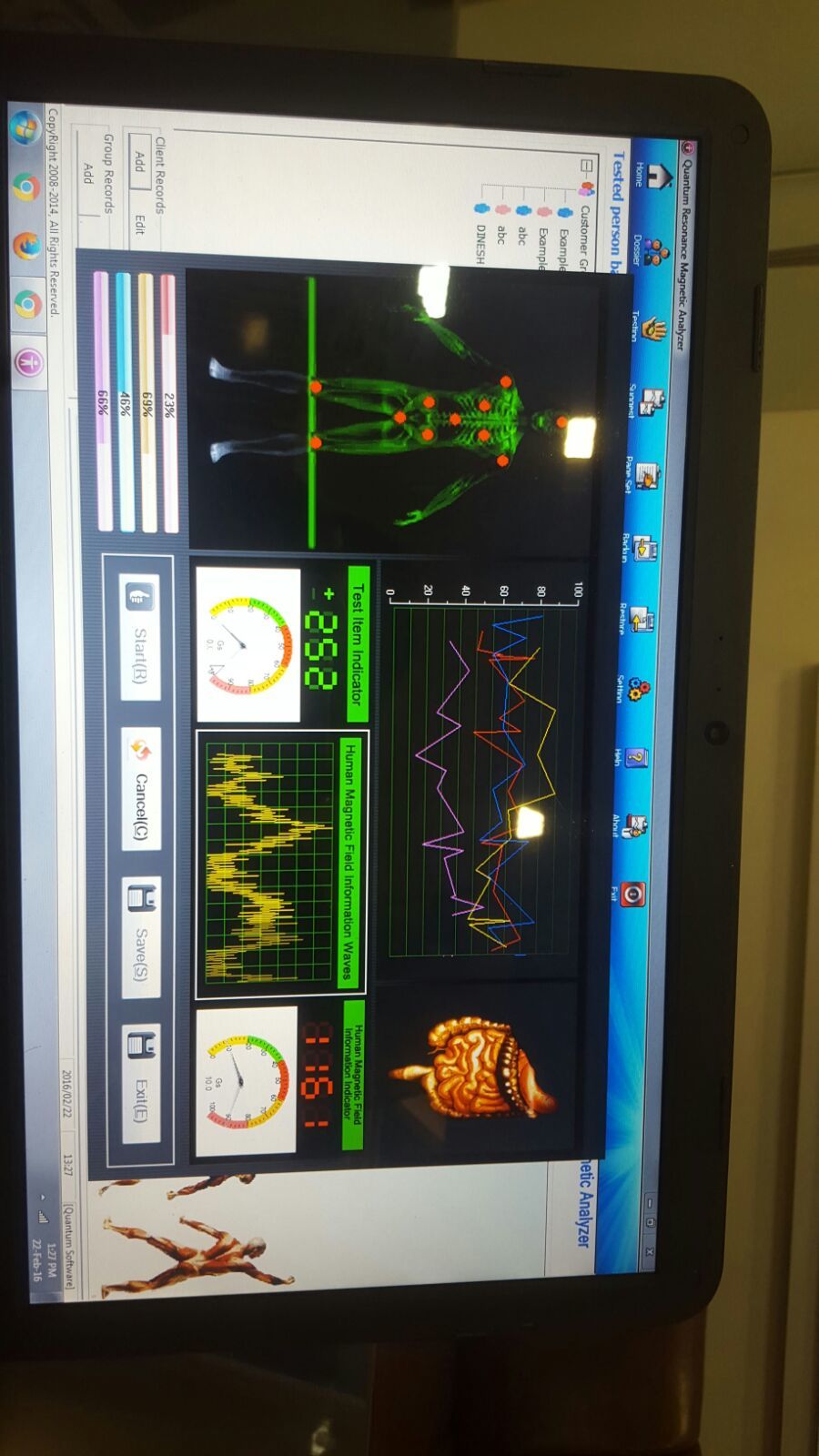 Quantum Magnetic Resonance Health Analyzer