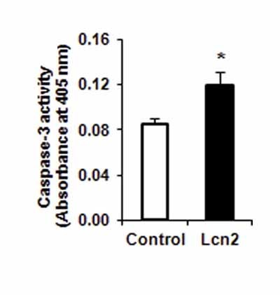 Caspase-3 Colorimetric Assay Kit 25 Test Price @13500/- 100 Test Price @29,000 Cas No: K106