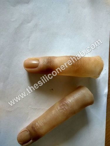 बिना नाखून के कृत्रिम अंगूठा