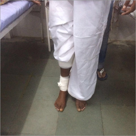 Kpd-daga टाइटेनियम नेल पैटिनेट