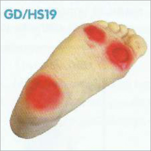 डायबिटिक फुट नर्सिंग सिम्युलेटर