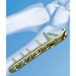 बोन प्लेट्स