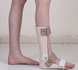 AFO - Fiber Manual Foot Support | Portable, Non-Recyclable, Non-Soluble Design