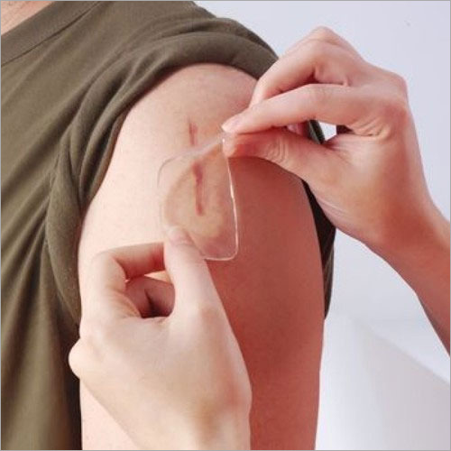 सिलिकॉन जेल शीट