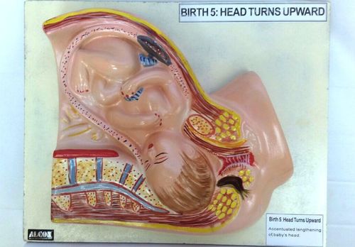 पीला और त्वचा के रंग का जन्म 5