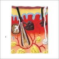 त्वचा का लाल मॉडल